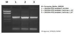 Abb._4_DNA-Banden_nach_einer_PCR